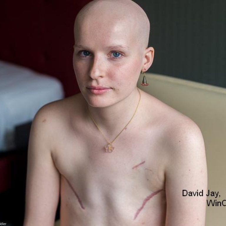 επιζώντες  του καρκίνου